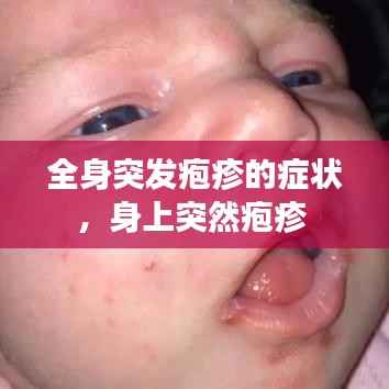 全身突发疱疹的症状，身上突然疱疹 